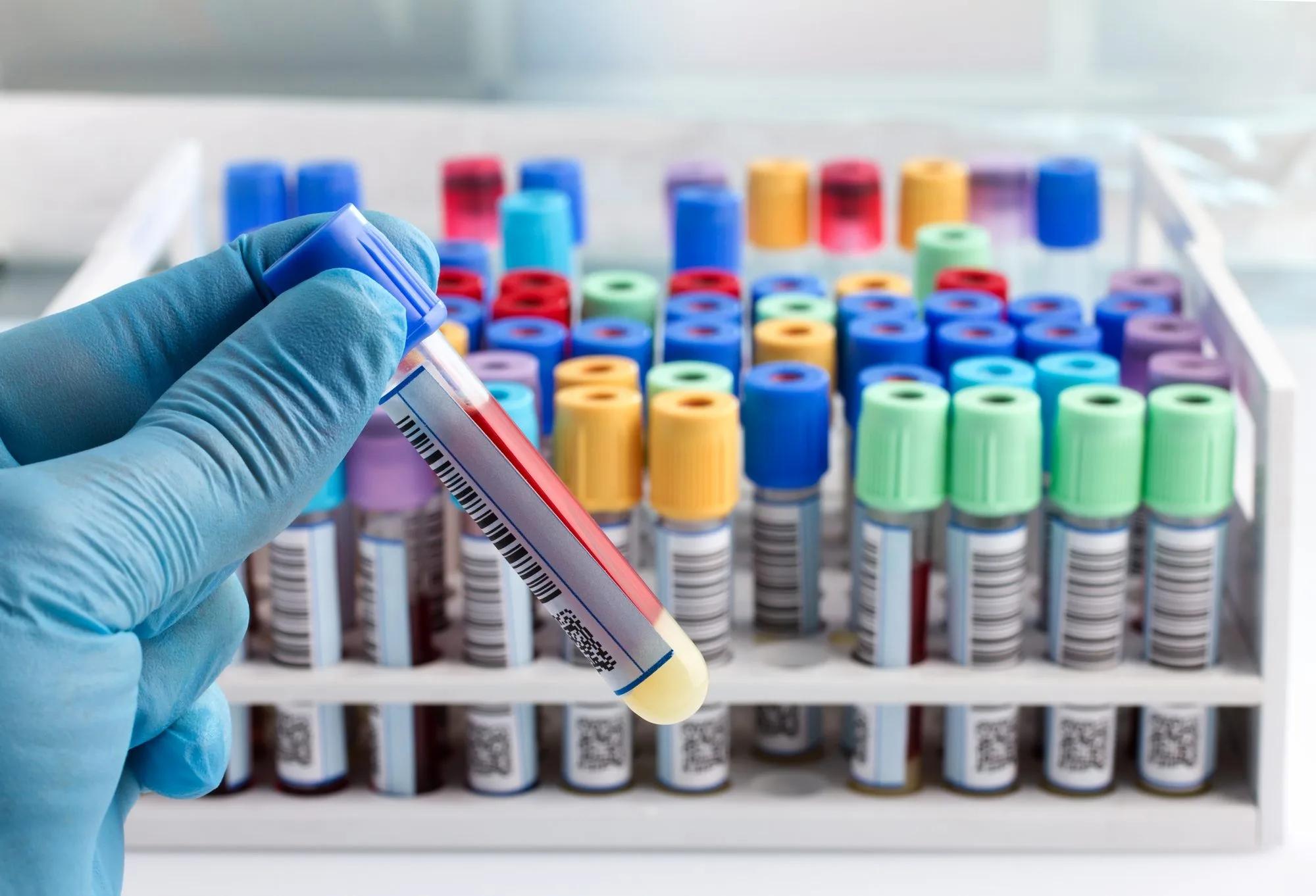 10 conditions médicales liées à la dépression