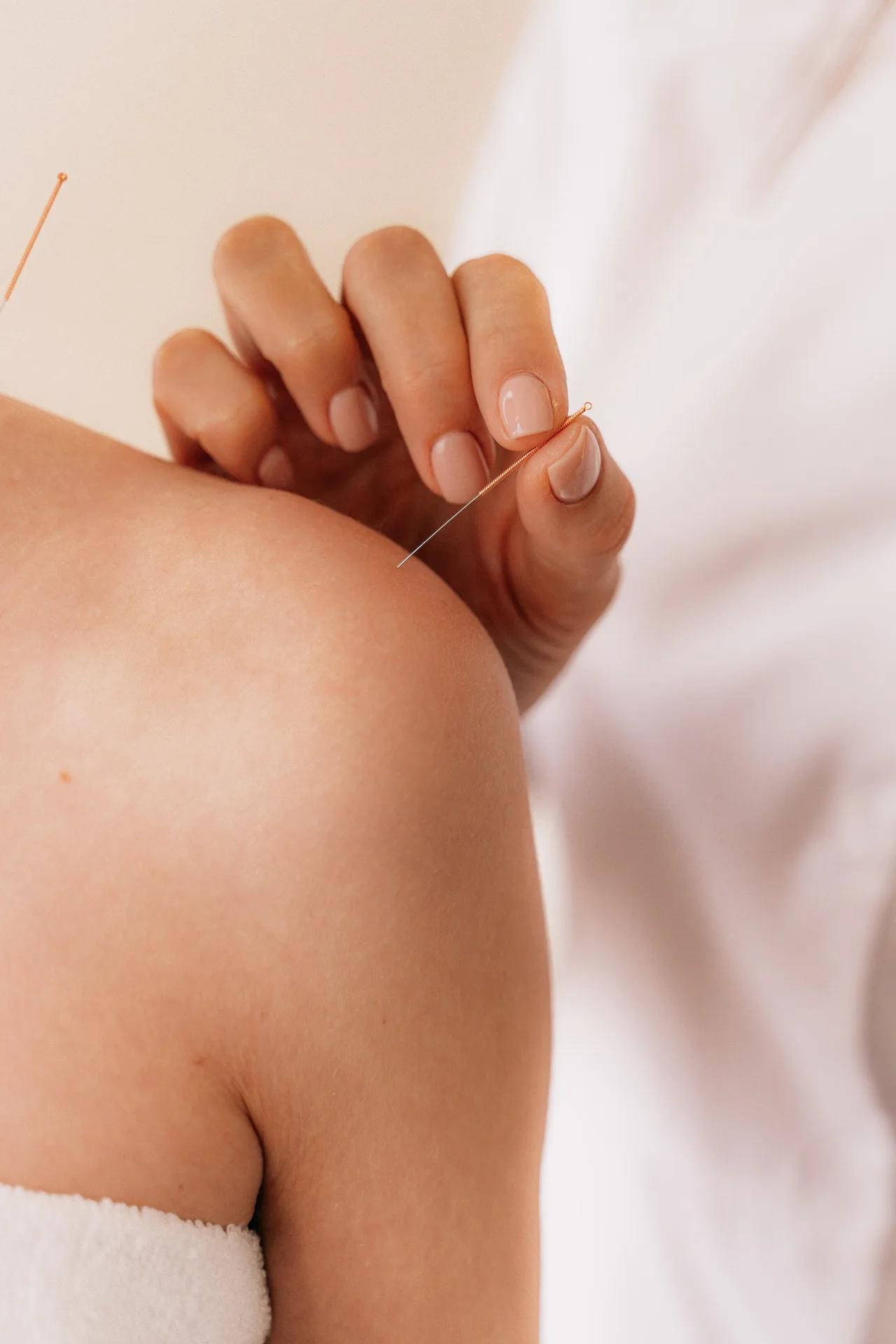 Sécurité de l’acupuncture pendant la grossesse : ce que vous devez savoir