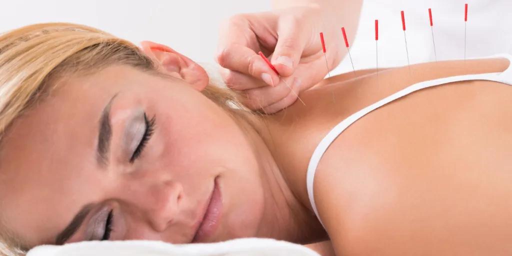 Comment les points d'acupuncture fonctionnent ?