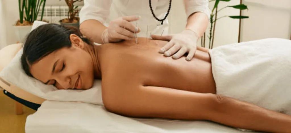 Séance d'acupuncture pour la perte de poids
