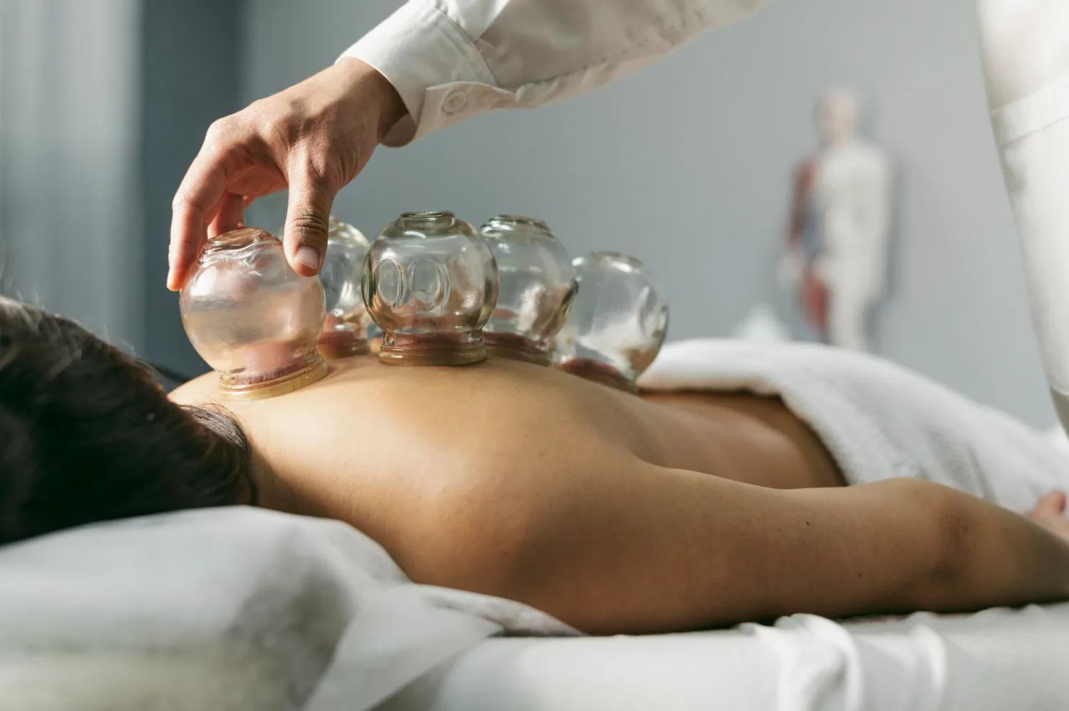 La thérapie par les ventouses : une méthode thérapeutique ancestrale à redécouvrir