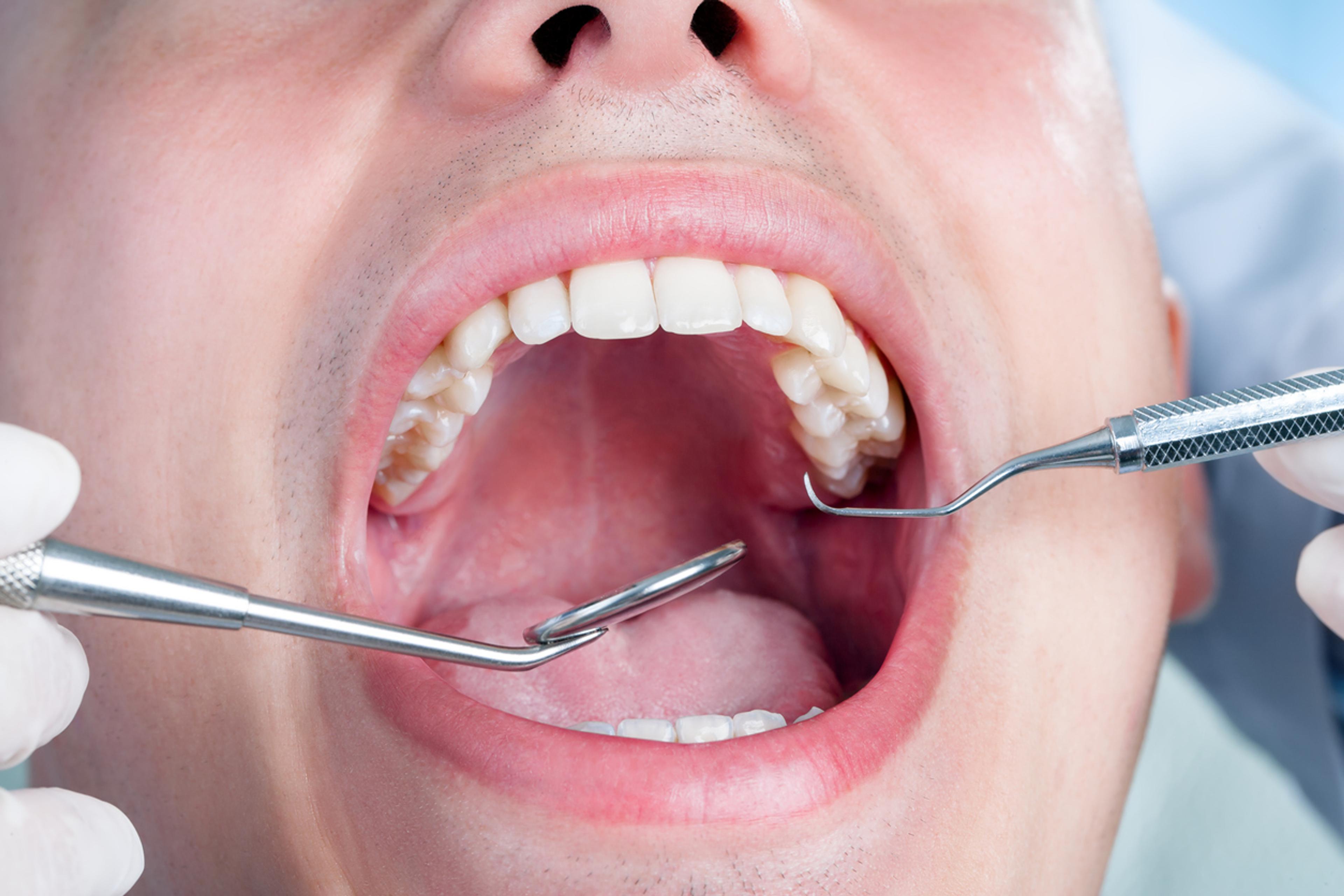 Dentist examining a patient's gums