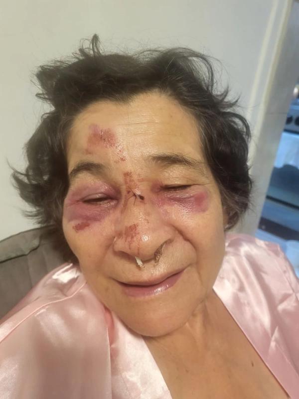 Violento robo en Mar del Plata: motochorros atacaron a una mujer de 75 años y la dejaron herida