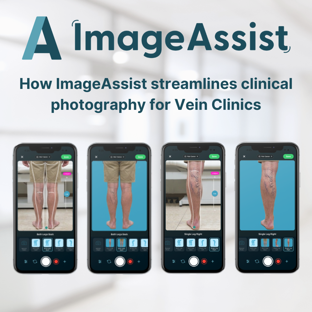Vein Photography