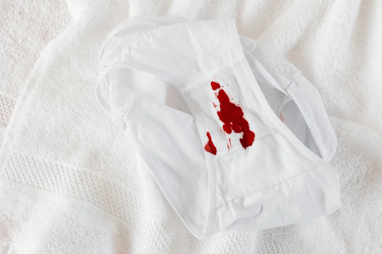 Braguita blanca con una mancha de sangre sobre una toalla blanca