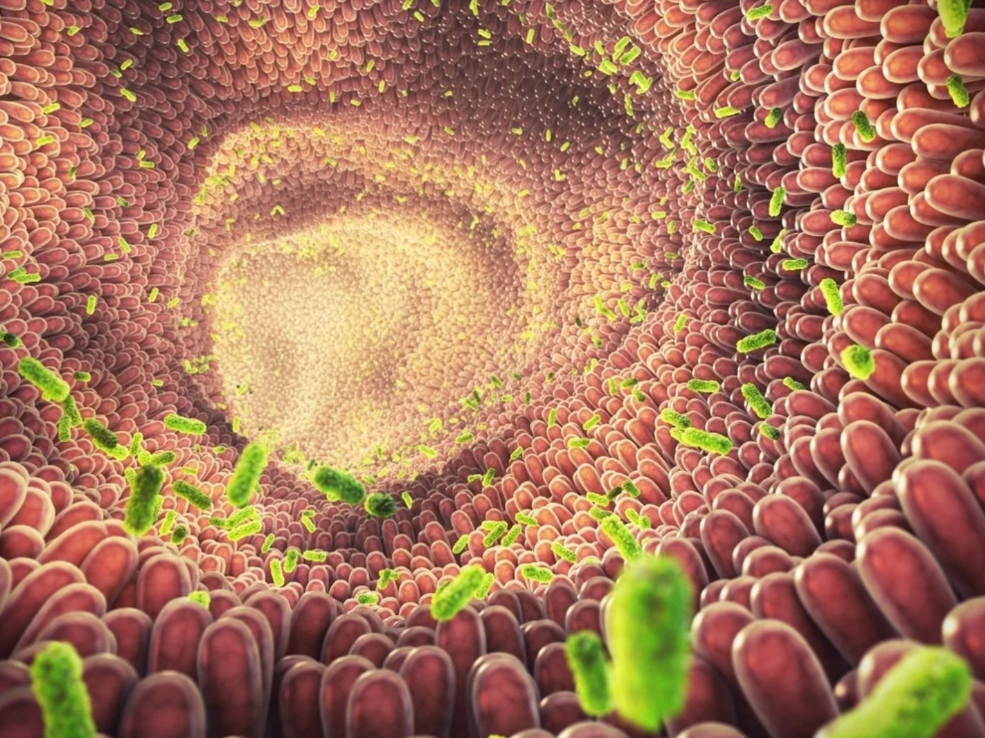 Disbiosis intestinal