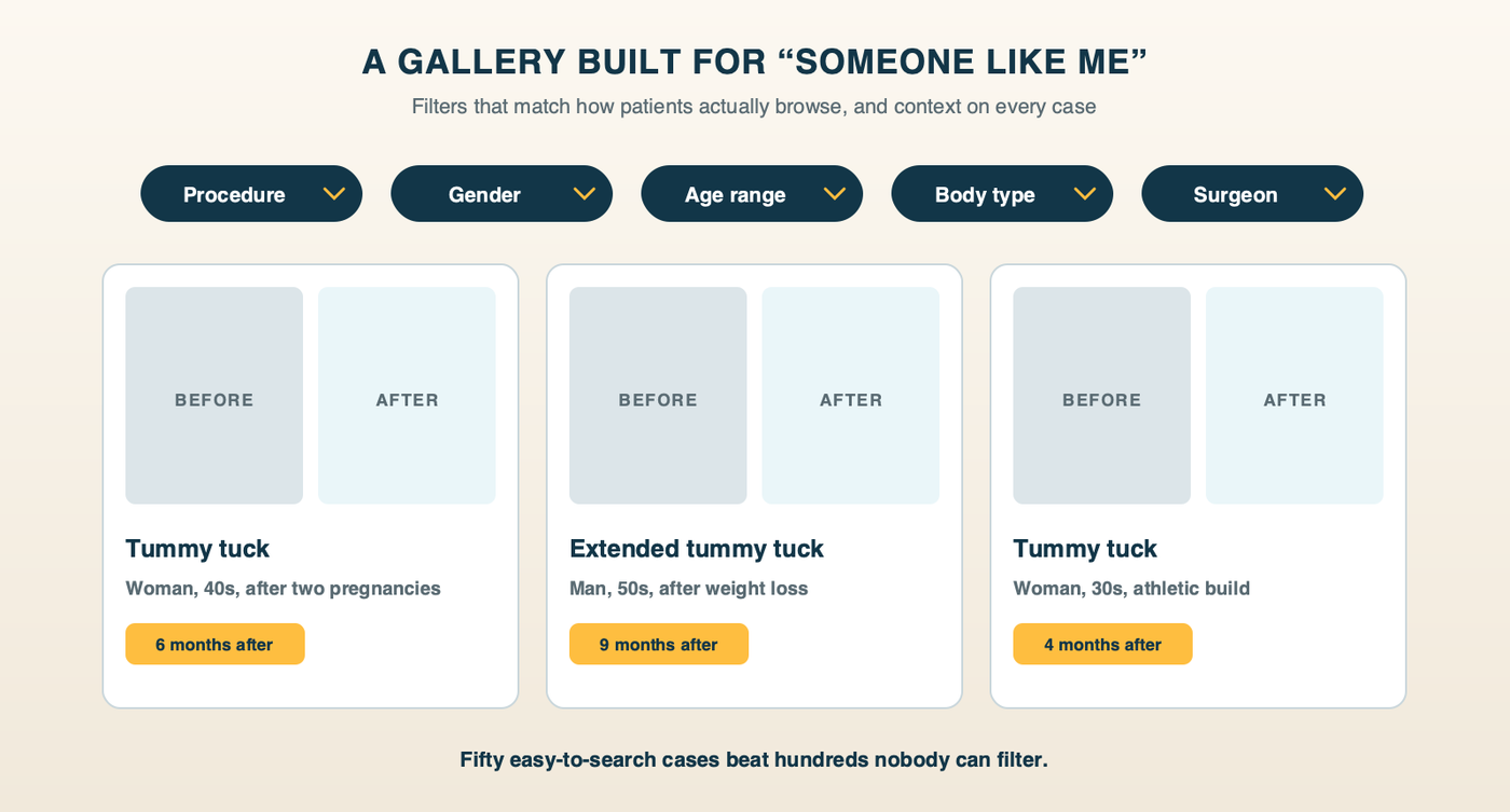 A before-and-after gallery built for someone like me: filters for procedure, gender, age range, body type and surgeon, each case card showing the procedure, the patient's age range and build, and months since surgery