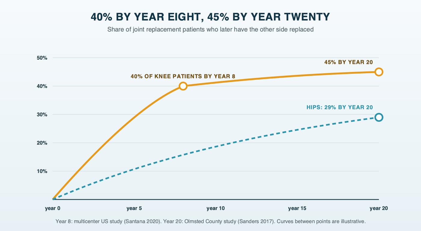 How many knee replacement patients come back for the other knee: about 40 percent by year eight in a multicenter US study and 45 percent by year twenty in an Olmsted County study, with hip patients lower at 29 percent by year twenty