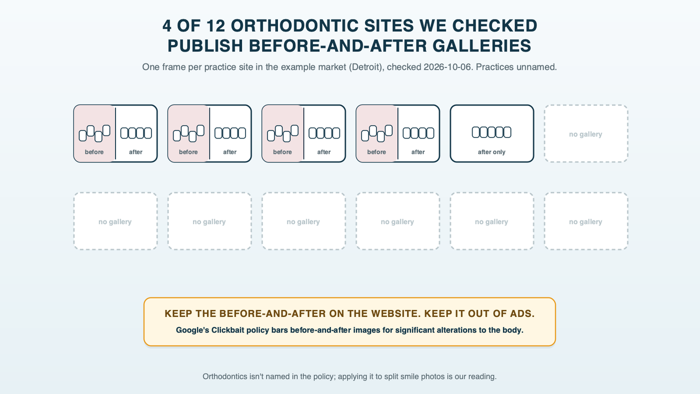 Twelve small smile frames for the 12 orthodontic practice sites checked in the example market, Detroit: four split down the middle into before and after and marked keep on the website, out of ads; one showing finished smiles only; seven with no gallery