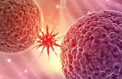 Studiu amplu: ce factori cresc riscul de cancer și pot fi controlați