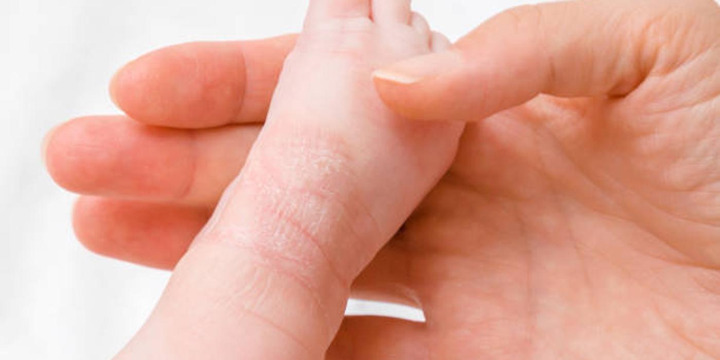 Sfaturi și trucuri privind igiena în cazul dermatitei atopice la copii