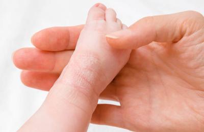 Sfaturi și trucuri privind igiena în cazul dermatitei atopice la copii