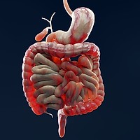 Bolile inflamatorii intestinale și rolul proctologiei în diagnostic și tratament