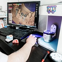 Lucrări dentare de calitate – pacienți mulțumiți. Cum alegi laboratorul partener potrivit?