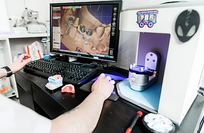 Lucrări dentare de calitate – pacienți mulțumiți. Cum alegi laboratorul partener potrivit?