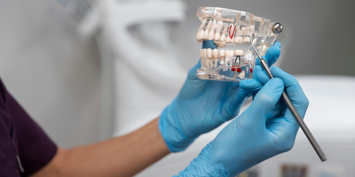 Refacerea osului maxilar prin grefe osoase: când este necesară pentru implant?