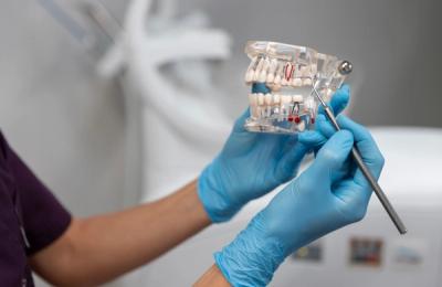 Refacerea osului maxilar prin grefe osoase: când este necesară pentru implant?