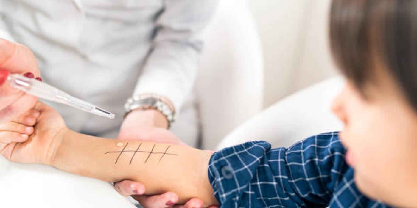 Dermatofitoza la copii