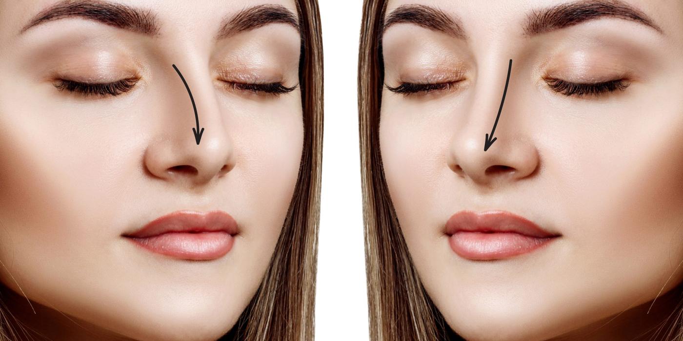 Transformare și Eleganță: Rinoplastia cu Dr. Bortolini la Clinica BePerfect din București