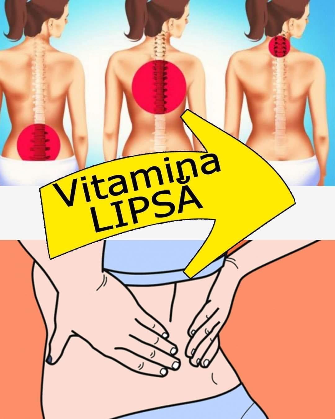 Durerile puternice de articulații și de spate au drept cauză lipsa unei singure vitamine
