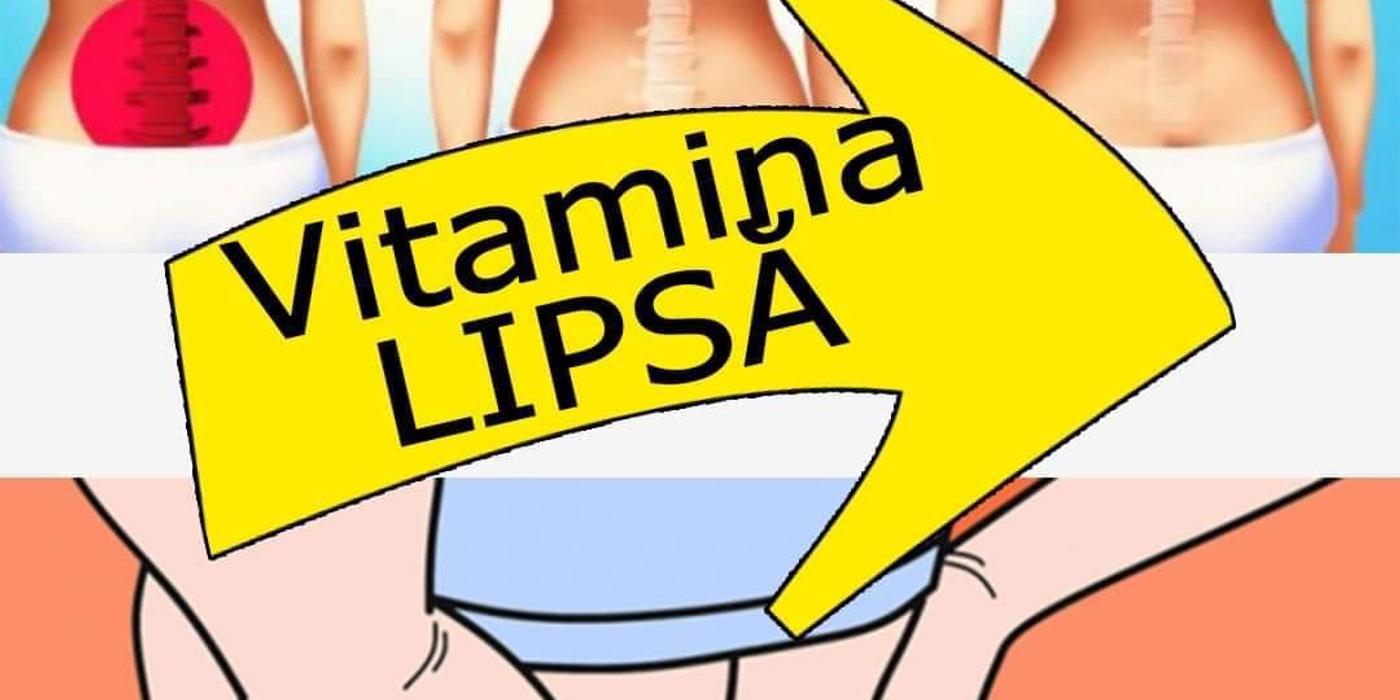 Durerile puternice de articulații și de spate au drept cauză lipsa unei singure vitamine