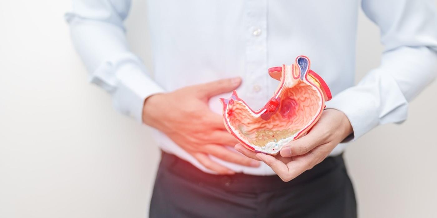 Opțiuni de tratament pentru ulcerul duodenal
