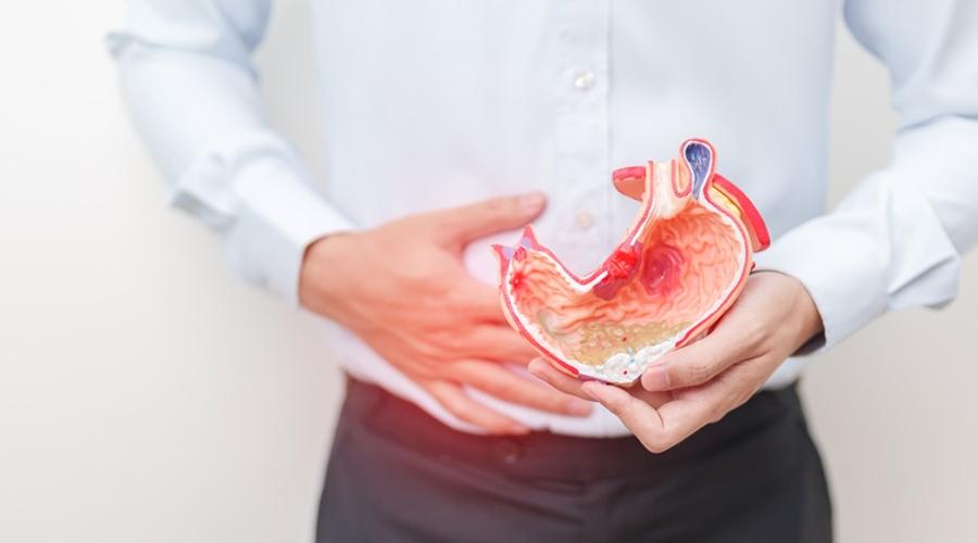 Opțiuni de tratament pentru ulcerul duodenal