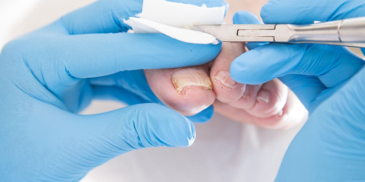 Podolog vs. dermatolog: Ghid pentru alegerea specialistului potrivit în funcție de simptome