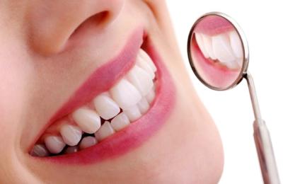 Cum ne alegem fațetele dentare potrivite?