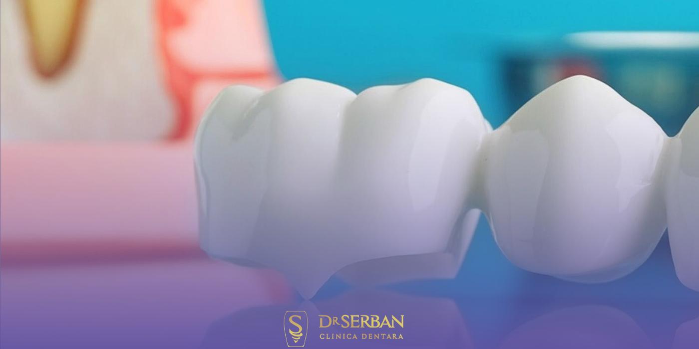 La ce prețuri ne așteptăm pentru coroane dentare în București? Clinica stomatologică Dr. Șerban