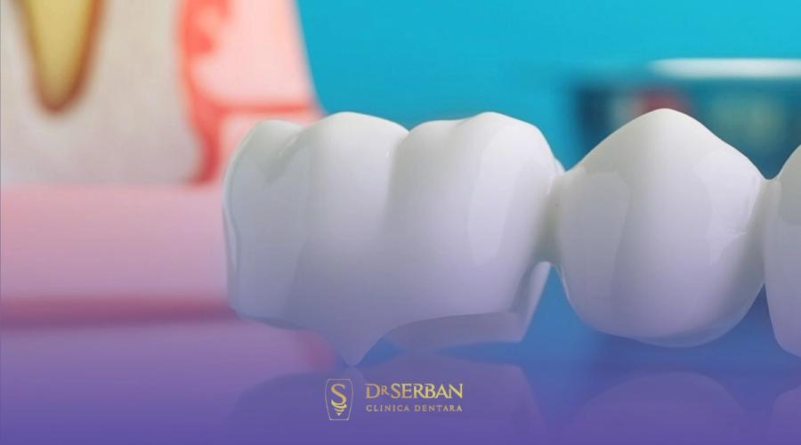 La ce prețuri ne așteptăm pentru coroane dentare în București? Clinica stomatologică Dr. Șerban