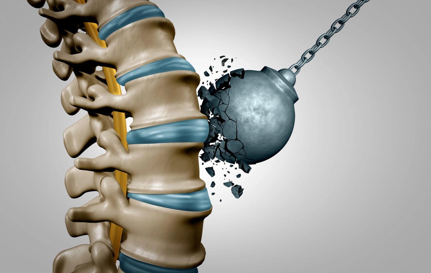 Tratamentul nechirurgical pentru hernia de disc: ce trebuie sa stiti!