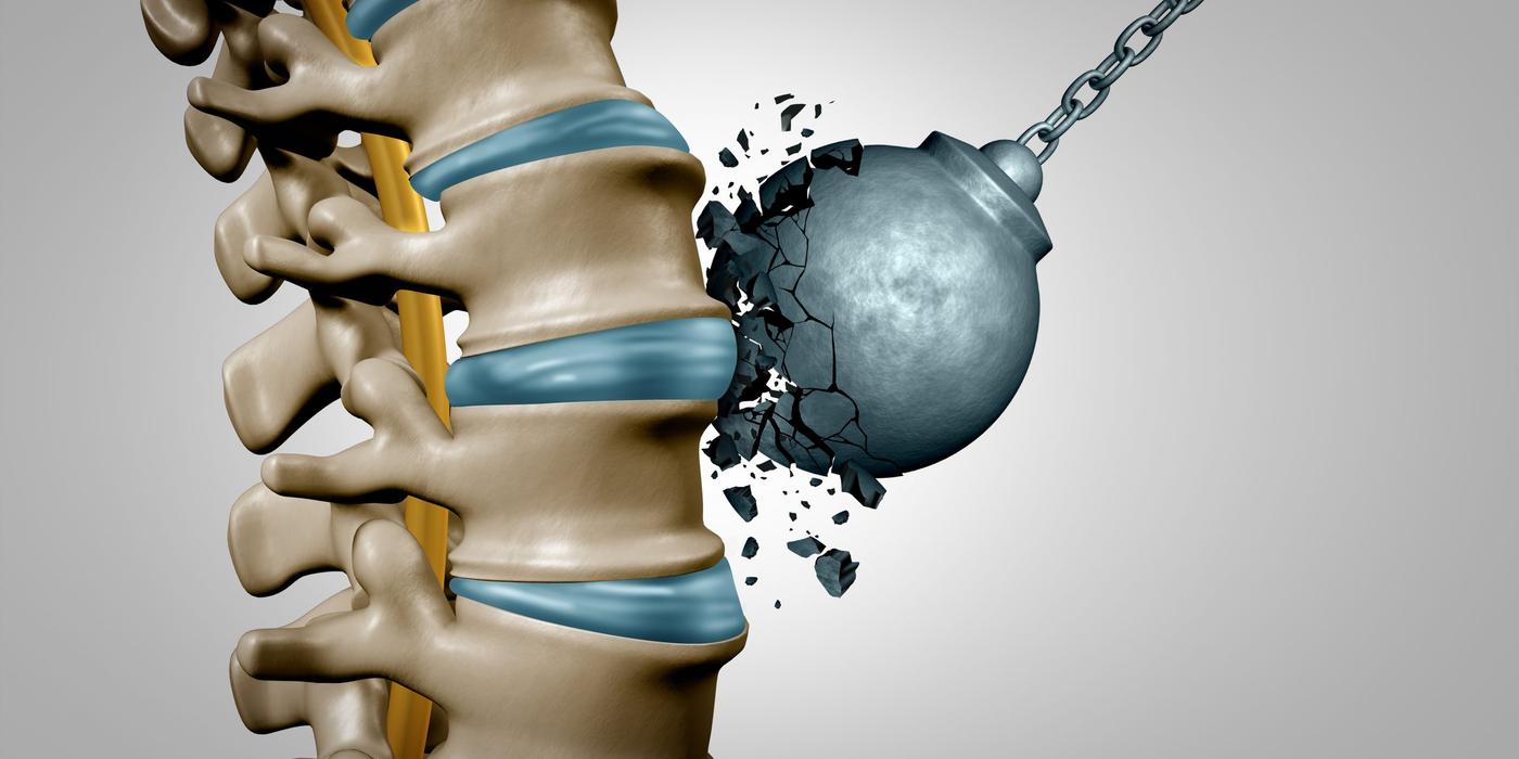 Tratamentul nechirurgical pentru hernia de disc: ce trebuie sa stiti!