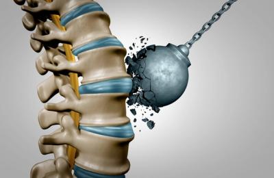 Tratamentul nechirurgical pentru hernia de disc: ce trebuie sa stiti!