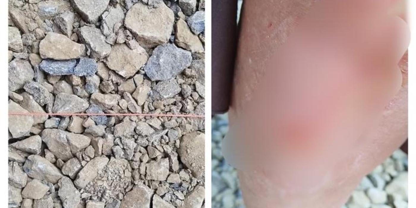 S-a ales cu genunchiul zdrelit, dupa ce a căzut in fata librăriei de pe strada Universități