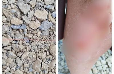 S-a ales cu genunchiul zdrelit, dupa ce a căzut in fata librăriei de pe strada Universități