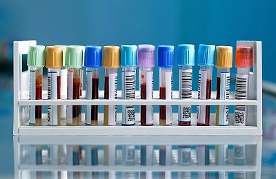 Cât costă prevenția medicală în 2026? Analizele și investigațiile de bază pot ajunge și la 6.000 de lei