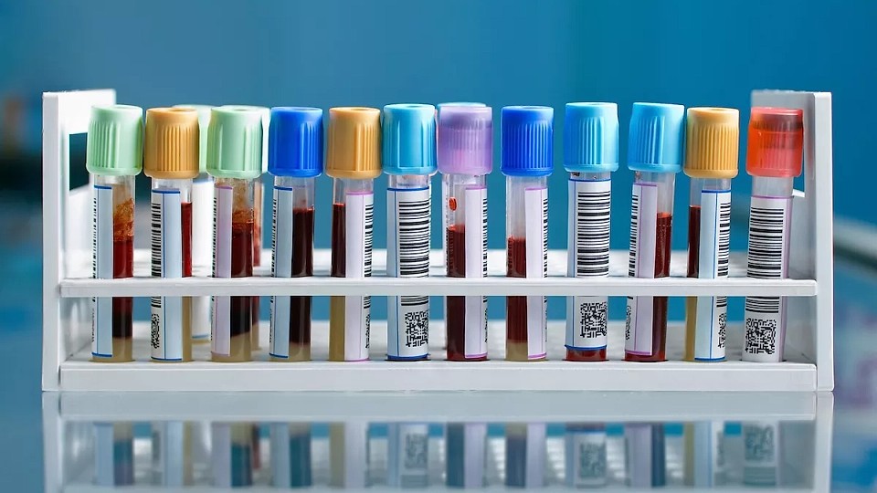 Cât costă prevenția medicală în 2026? Analizele și investigațiile de bază pot ajunge și la 6.000 de lei