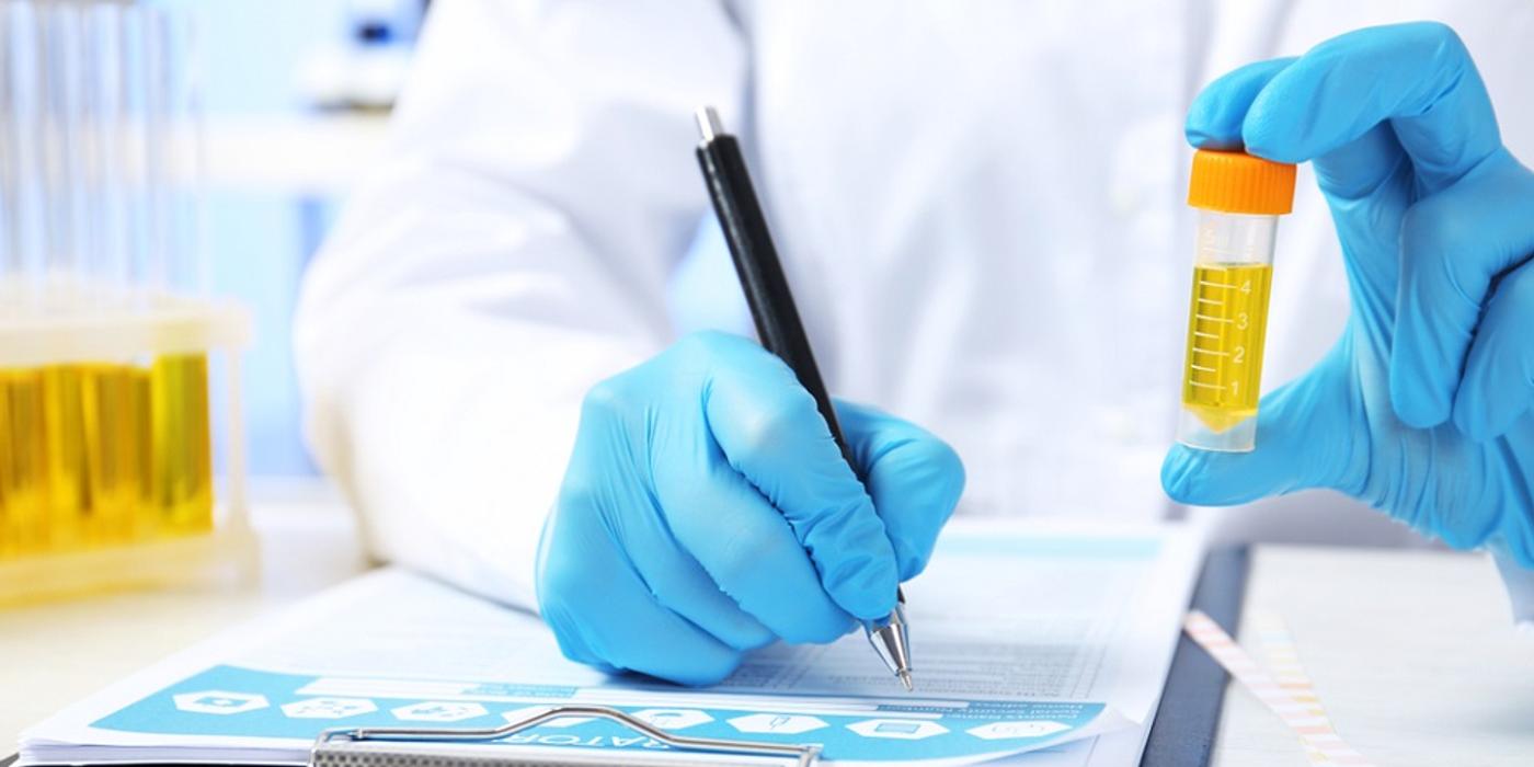 Când este recomandată testarea creatininei urinare?