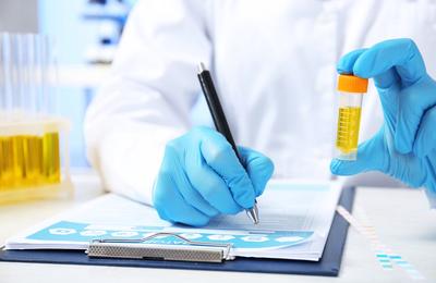 Când este recomandată testarea creatininei urinare?