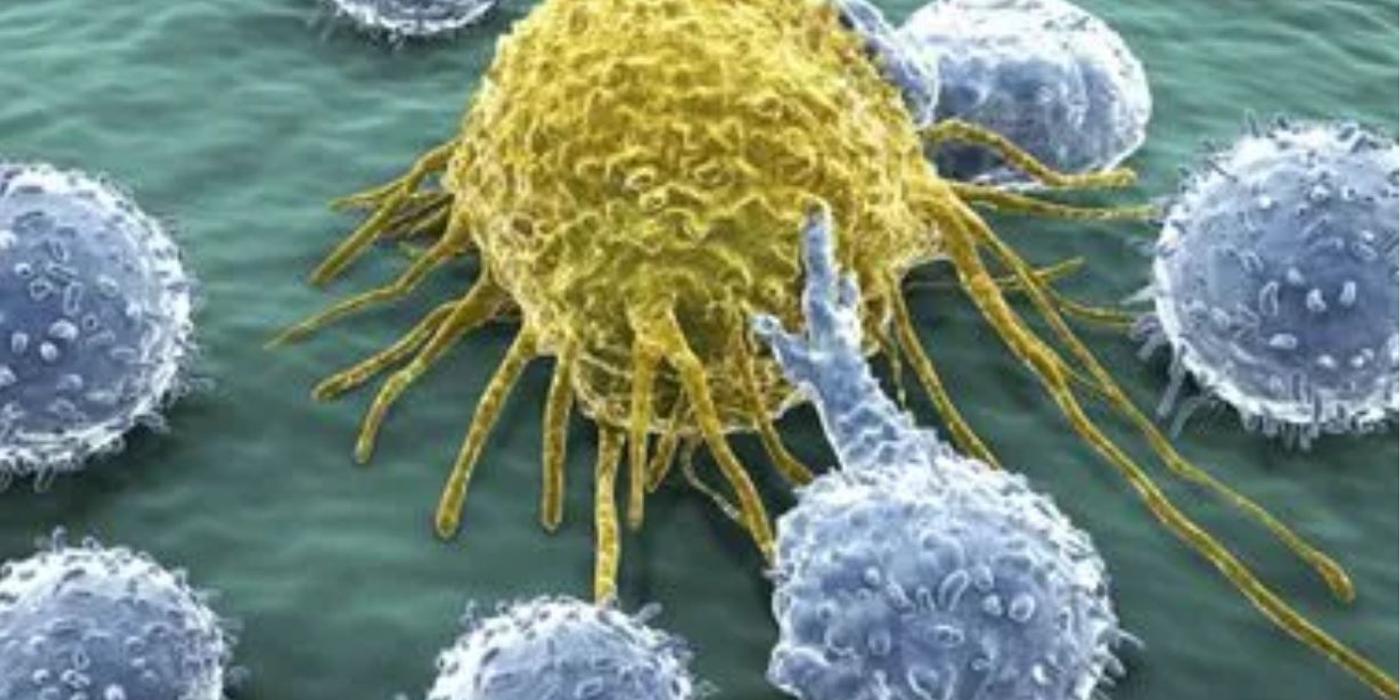 Unul dintre cei mai agresivi inamici ai corpului poate fi cancerul