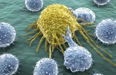 Unul dintre cei mai agresivi inamici ai corpului poate fi cancerul