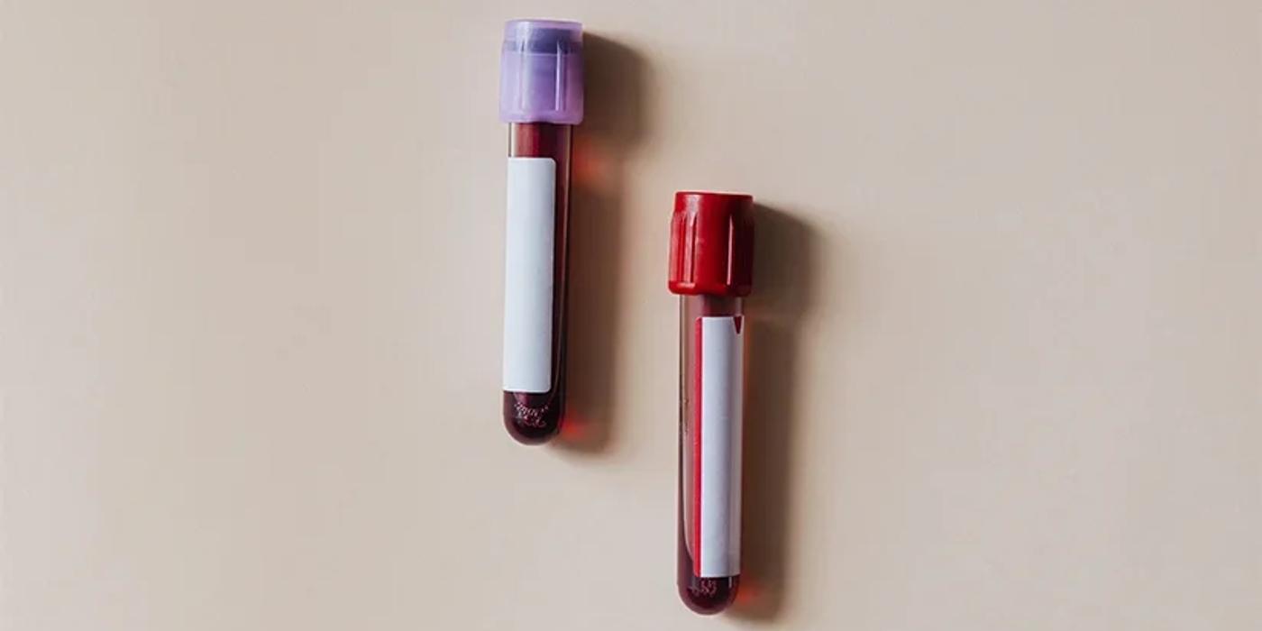 Totul despre pH-ul organismului: ce semnifica si care sunt valorile posibile