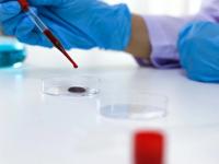 Ce se știe până acum despre ciuma din Rusia. Regimul de la Kremlin susține că nu se confirmă infectarea crecetătoarei