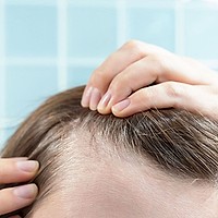 Remedii naturale pentru un scalp mai sănătos, conform specialiștilor – ghid complet pentru un păr puternic și strălucitor