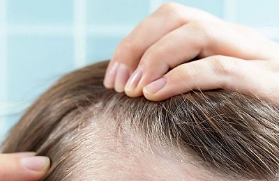 Remedii naturale pentru un scalp mai sănătos, conform specialiștilor – ghid complet pentru un păr puternic și strălucitor