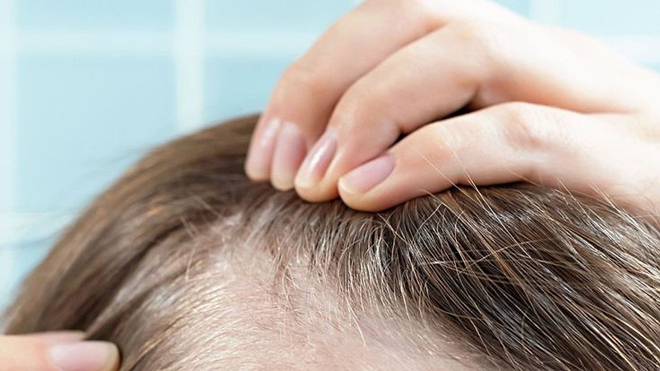 Remedii naturale pentru un scalp mai sănătos, conform specialiștilor – ghid complet pentru un păr puternic și strălucitor
