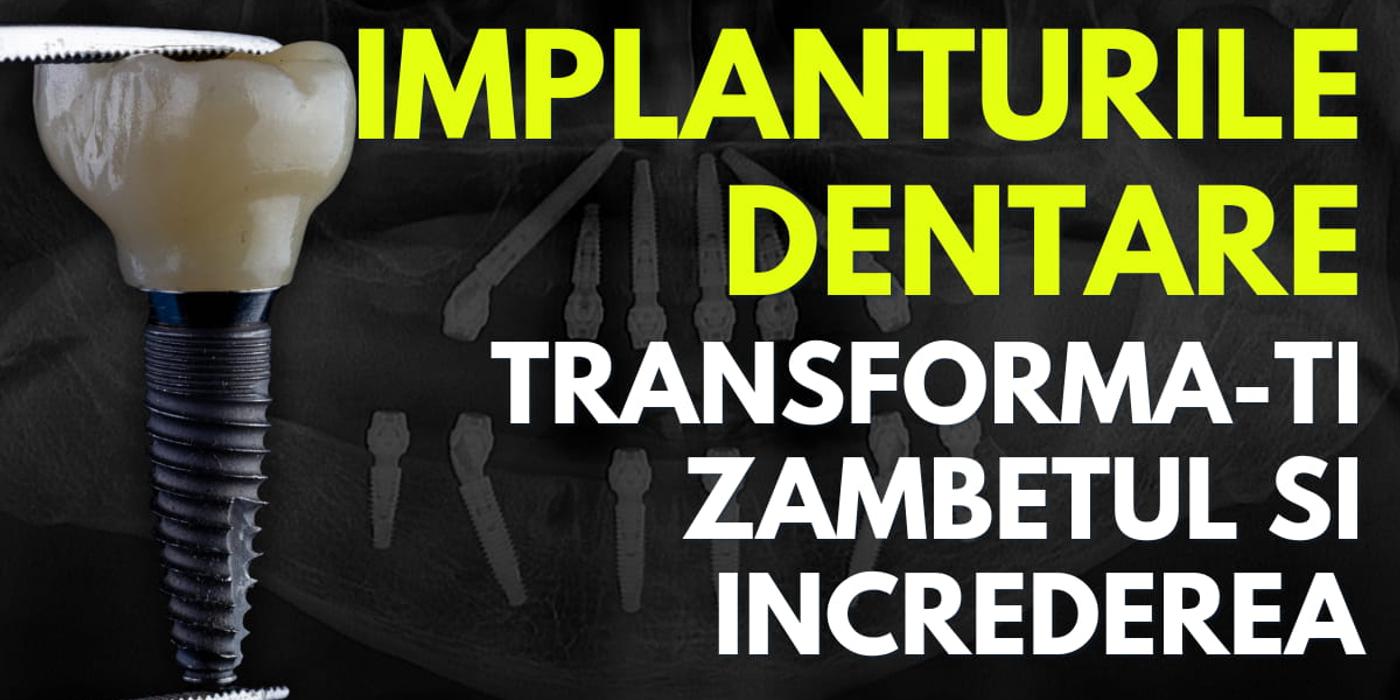Implanturile Dentare: Transforma-ti zambetul si increderea