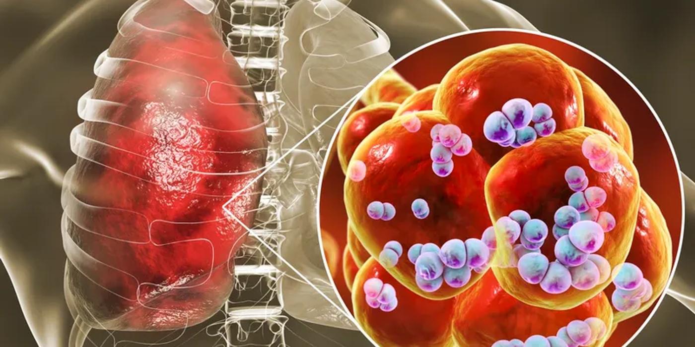 Epidemia gravă care a lovit grav un oraș din România. 3 pacienți au murit, alți 120 sunt internați