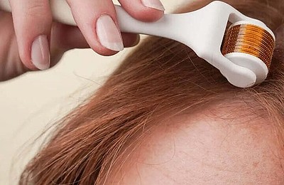 Derma roller pentru creșterea părului: cum funcționează și când dă rezultate, potrivit specialiștilor